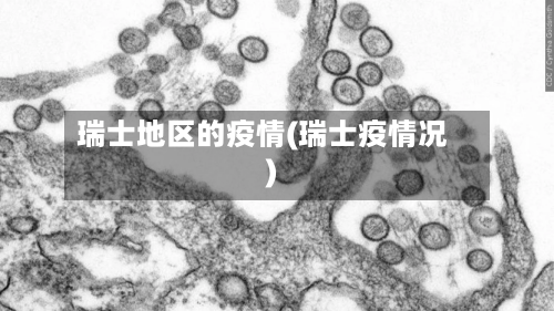 瑞士地区的疫情(瑞士疫情况)